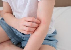 Çocuklarda &apos;Alerjik Hastalıklar' Hakkında Doğru Sanılan 8 Hatalı Bilgi!